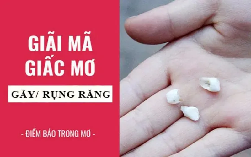 Mơ thấy rụng răng là điềm báo LÀNH hay DỮ? Con số may mắn